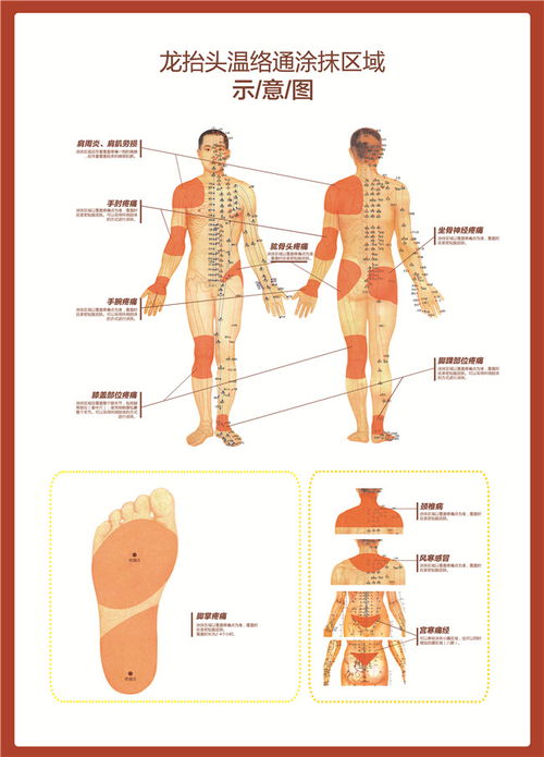 新丰温络通精油招商 龙抬头欢迎您咨询 温络通精油招商哪里有